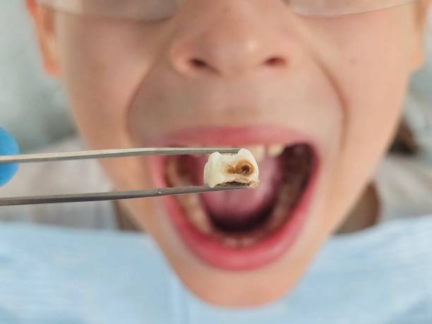 Best Urgent Dental Care for Toothaches in Simpson, PA